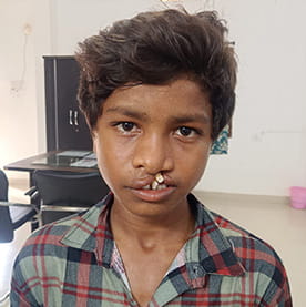 जब मुस्कान बनी नई पहचान… ‘चिरायु’ दल ने बदल दी एक जीवन की कहानी जब मुस्कान बनी नई पहचान… ‘चिरायु’ दल ने बदल दी एक जीवन की कहानी
